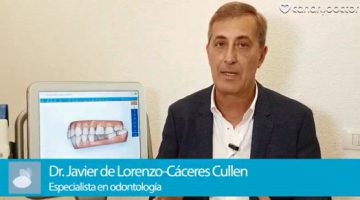 capture invisalign 2