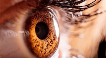 Dr-Humberto-Carreras-Diaz-Eyes (1)