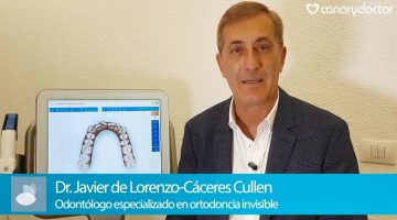 Invisalign en Tenerife. El Dr. Javier de Lorenzo-Cáceres Cullen nos explica este novedoso sistema de ortodoncia invisible en Tenerife.