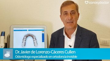 Invisalign auf Teneriffa. Dr. Javier de Lorenzo-Cáceres Cullen erklärt dieses neue unsichtbare kieferorthopädische System auf Teneriffa.